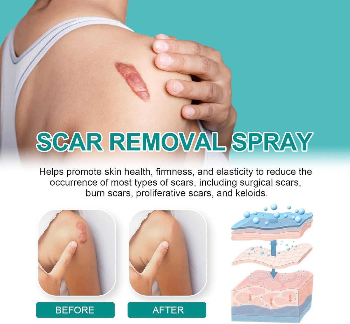 Spray para cicatrices - additional image 4