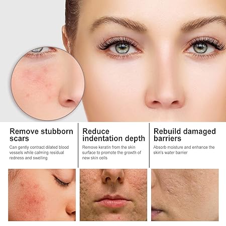 Serum facial con nicotinamida para cuidado de la piel - additional image 13